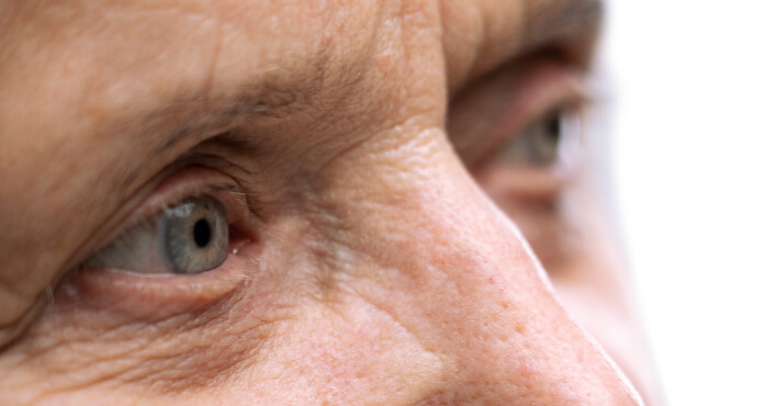 Scleral Lenses: When Things Go Wrong
