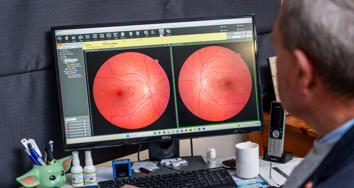 A Review of Fundus Autofluorescence Imaging