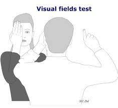 Drawing of a confrontation visual field test