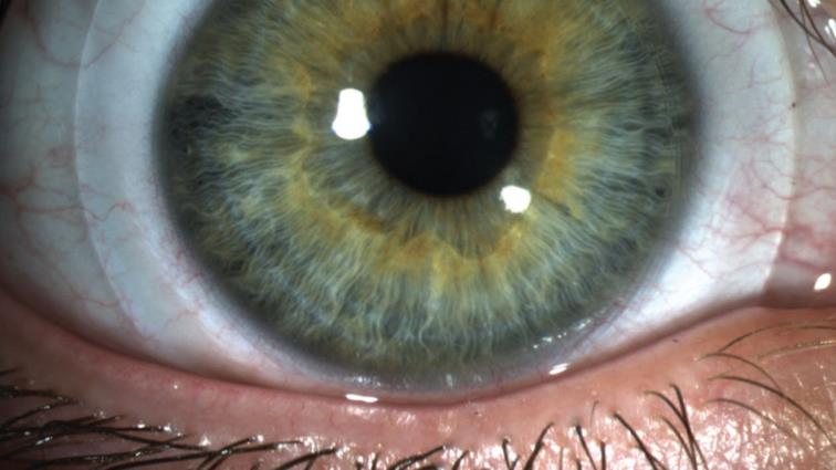 Close-up of an eye