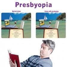 Presbyopia illustration: normal vision and vision with presbyopia