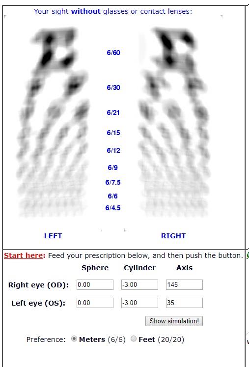 Simulated vision on a Snellen chart without glasses for -3.00 cylinder in both eyes