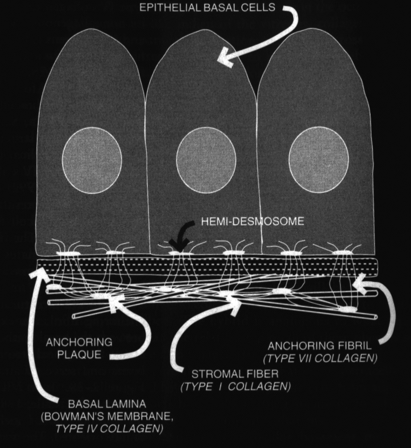 Diagram of corneal basal cells, basal lamina and the types of corneal collagen