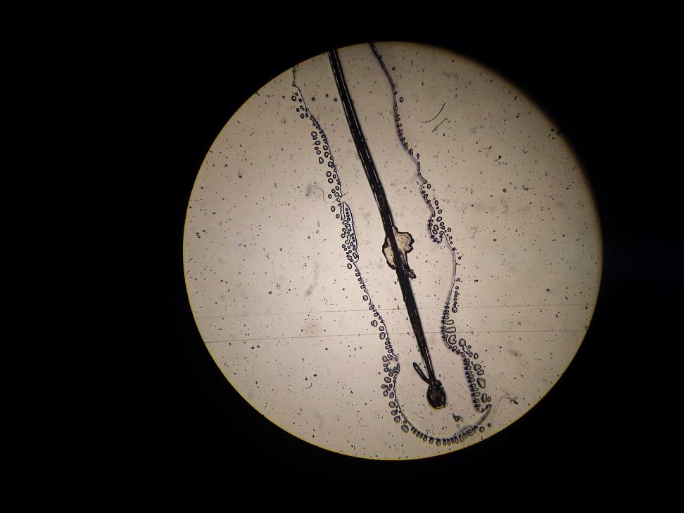 Epilated eyelash under a light microscope
