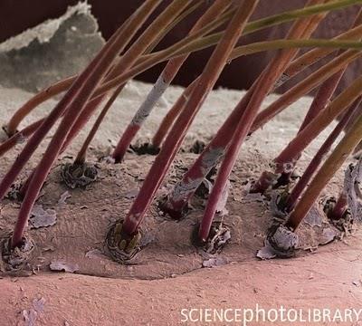 Coloured electron micrograph of hairs emerging from skin follicles