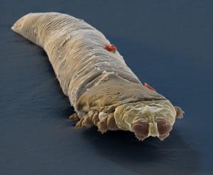 Coloured electron micrograph of a demodex mite