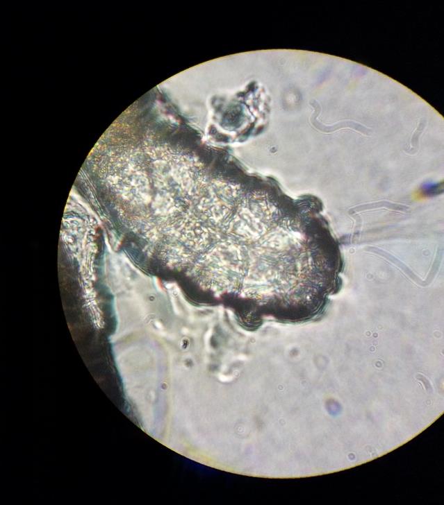 Eyelash root with demodex mites under a light microscope