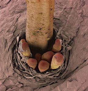 Coloured electron micrograph of demodex mites with their tails sticking out of a hair follicle