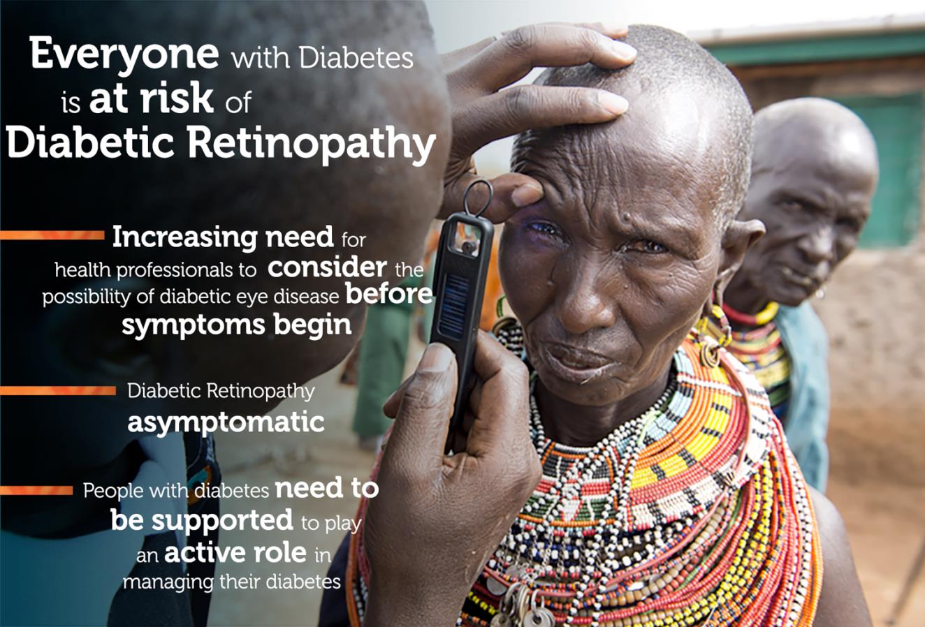 Everyone with diabetes is at risk of diabetic retinopathy - eye examination in Africa