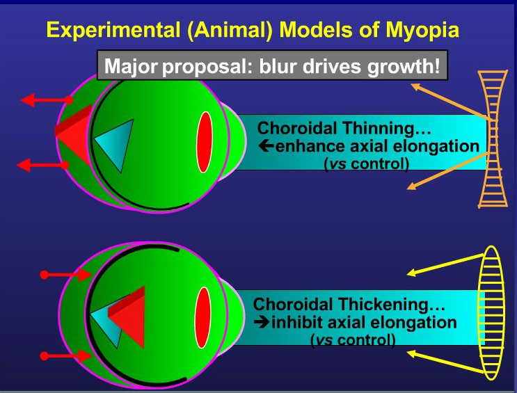 Diagram of experimental animal models of myopia: choroidal thinning and thickening with minus and plus lenses