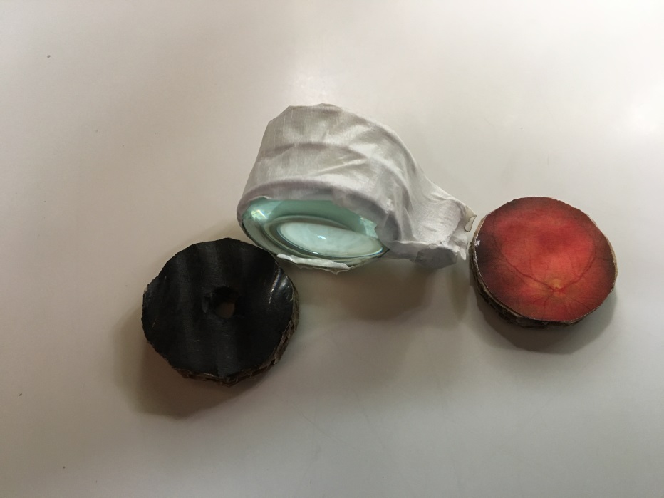 High plus lenses taped together with masking tape beside the pupil and fundus discs