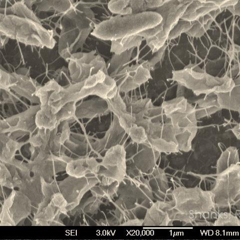 Scanning electron microscope image of a biofilm