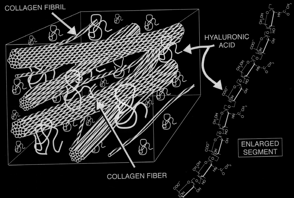 Diagram of a section of vitreous showing collagen fibrils and hyaluronic acid